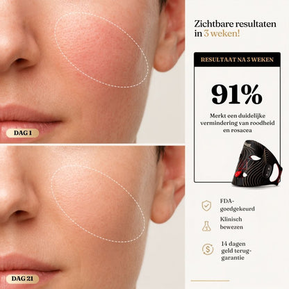 INIA Red Light Therapy Mask - Professionele LED-lichttherapie voor een zichtbaar gladdere, stevigere en stralende huid.